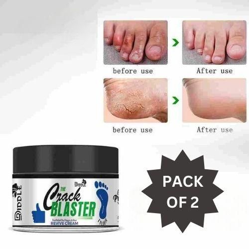 Driddle Foot Crack Remover Cream For Women & Men Pack of 2